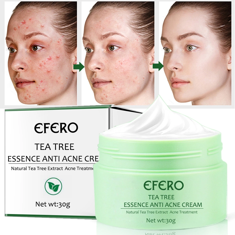 Tea Tree Acne Cream Moisturizer Scars Blackhead Removal Acne Treatment Cream Skin Whitening Cream Face Creams Skin Care